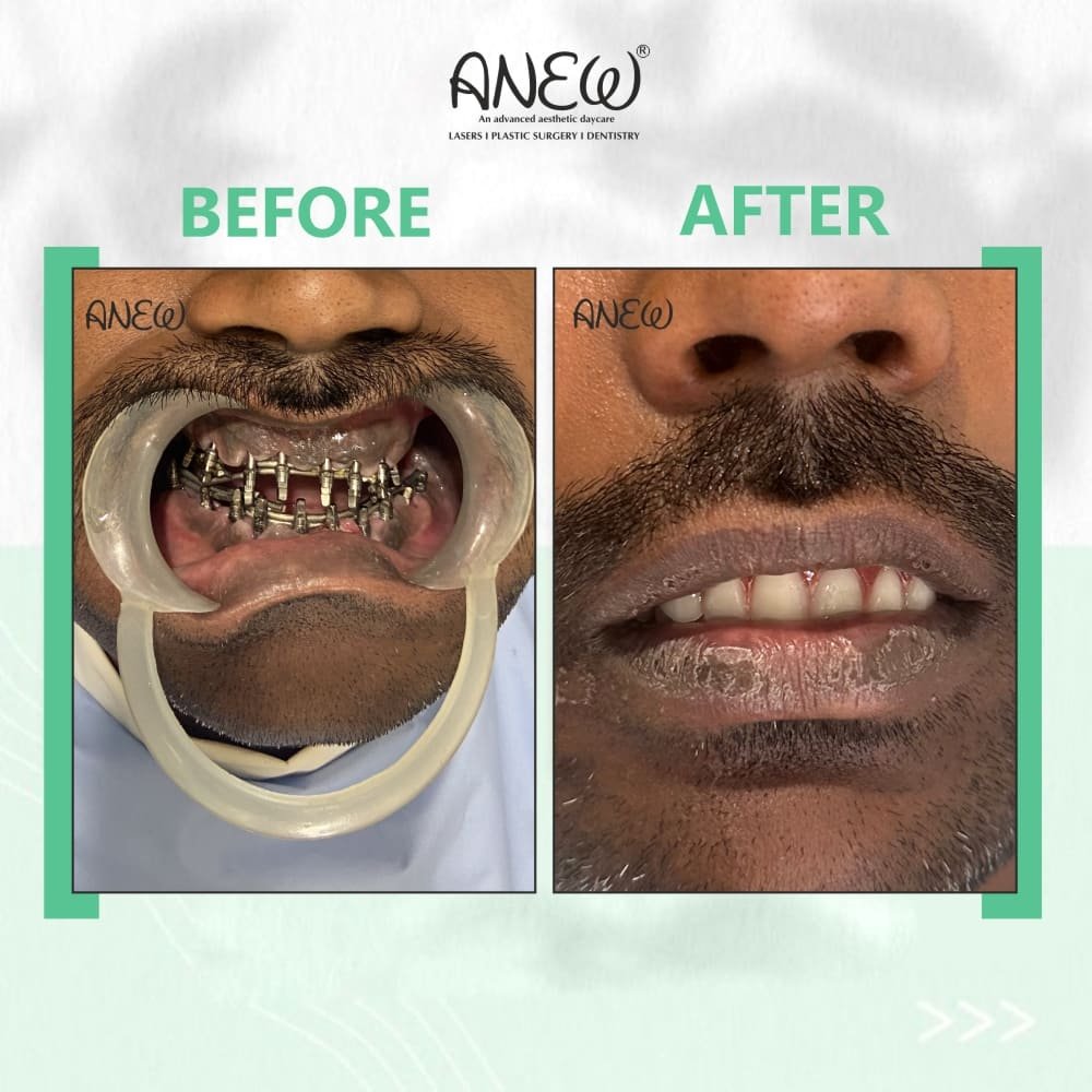 Rajesh Before and After image