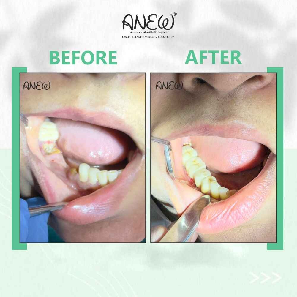 Sujatha Before and After image
