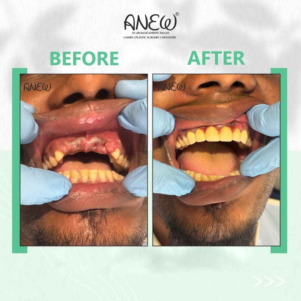 Surya Before and After image