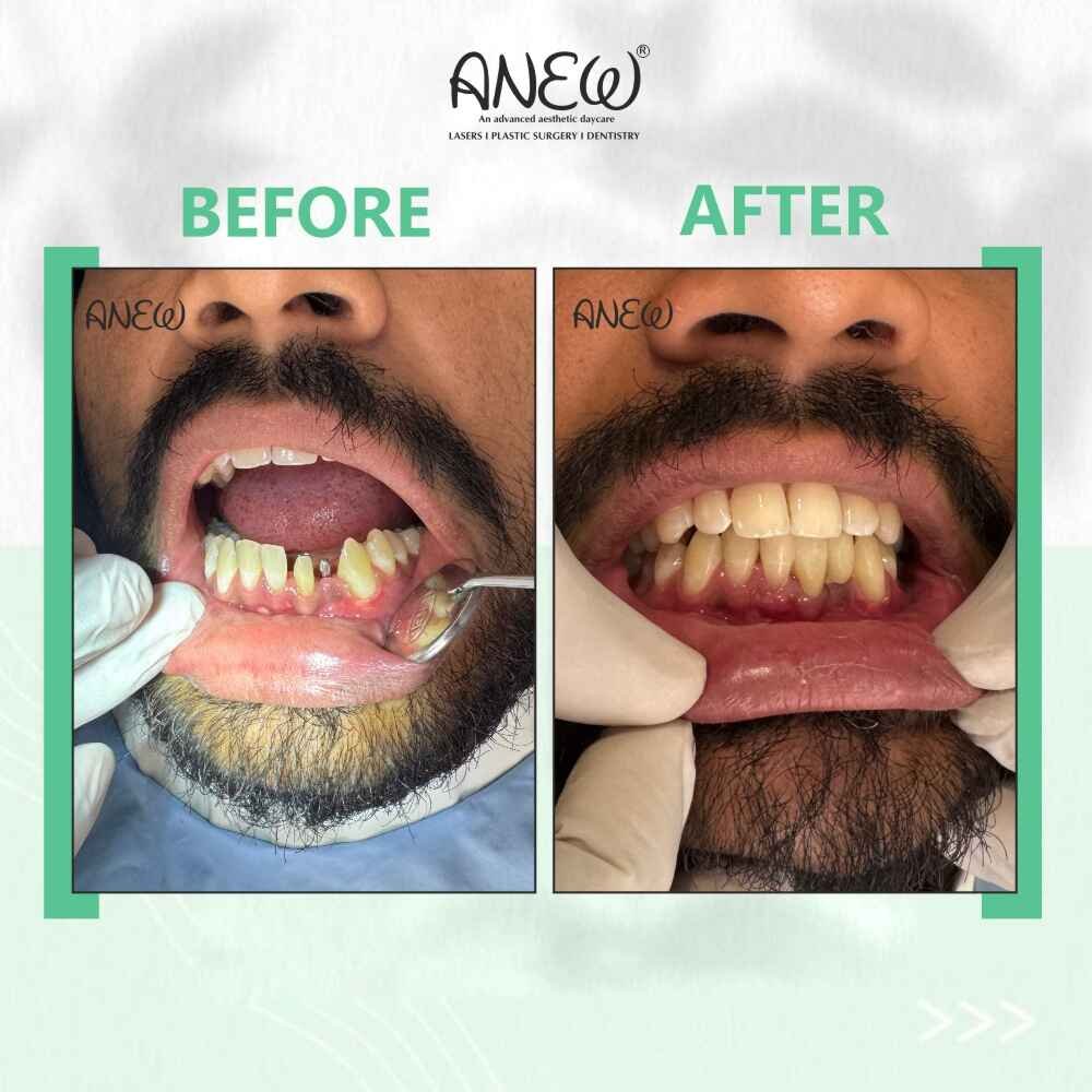 Vinod Before and After image