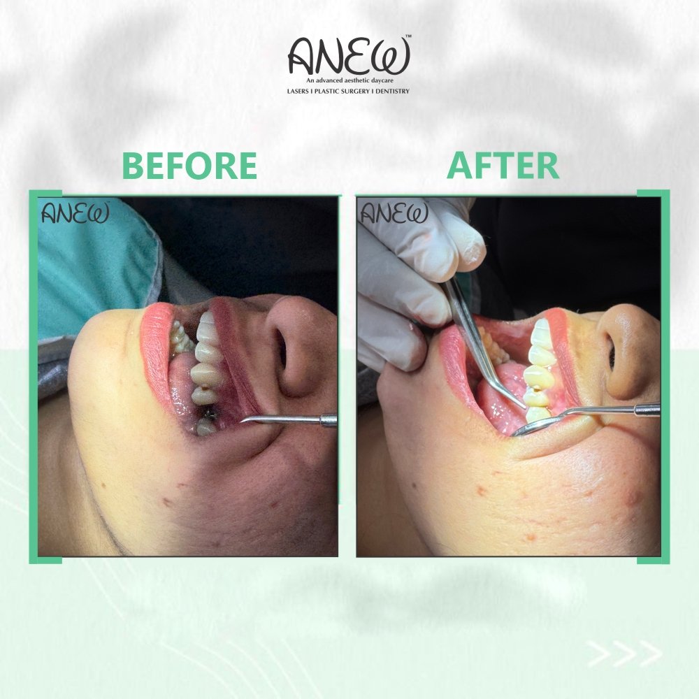   Before and After image