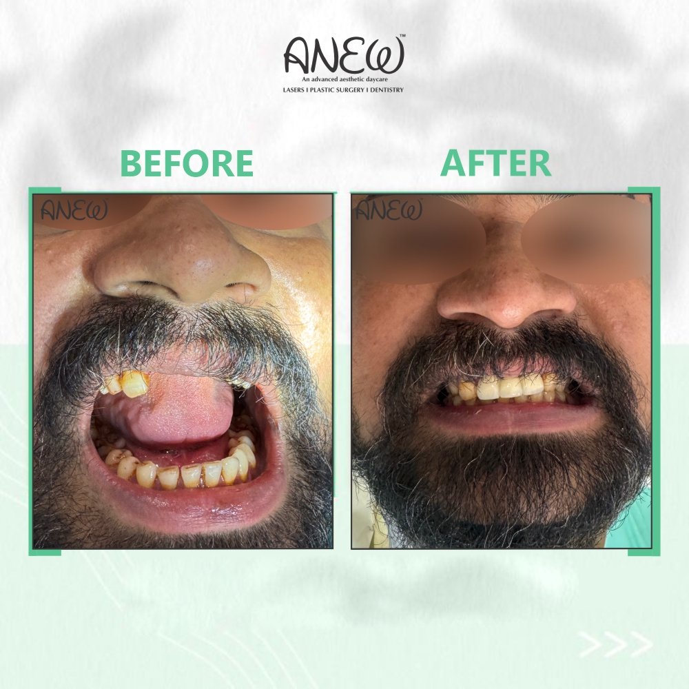   Before and After image1