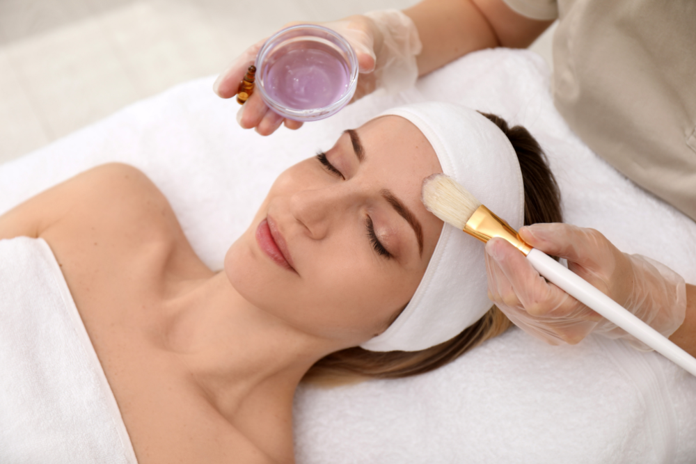Different types of chemical peels for acne