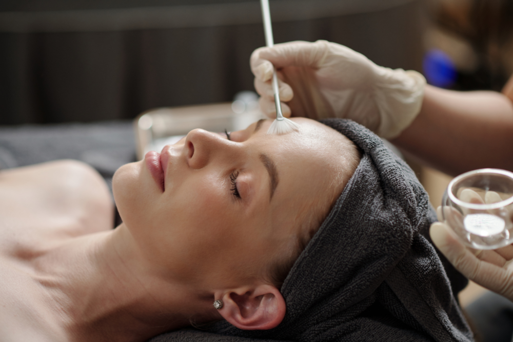 Professional chemical peel treatment for acne