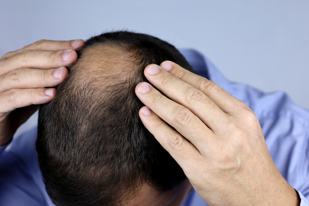 how do i choose the right hair loss treatment