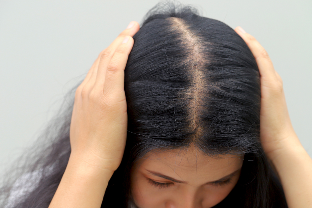 How to choose the right treatment for my hair loss
