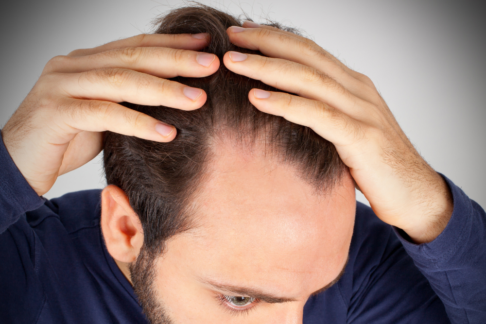 How can I choose the right hair loss treatment