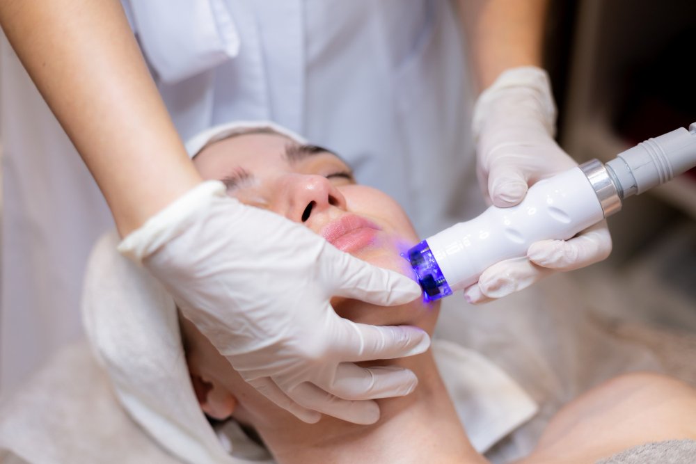 how long to see results after acne scar treatment