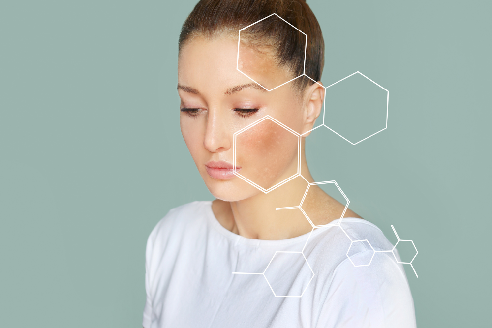 Best treatment for uneven skin tone