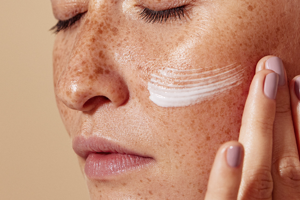 difference between pigmentation and melasma