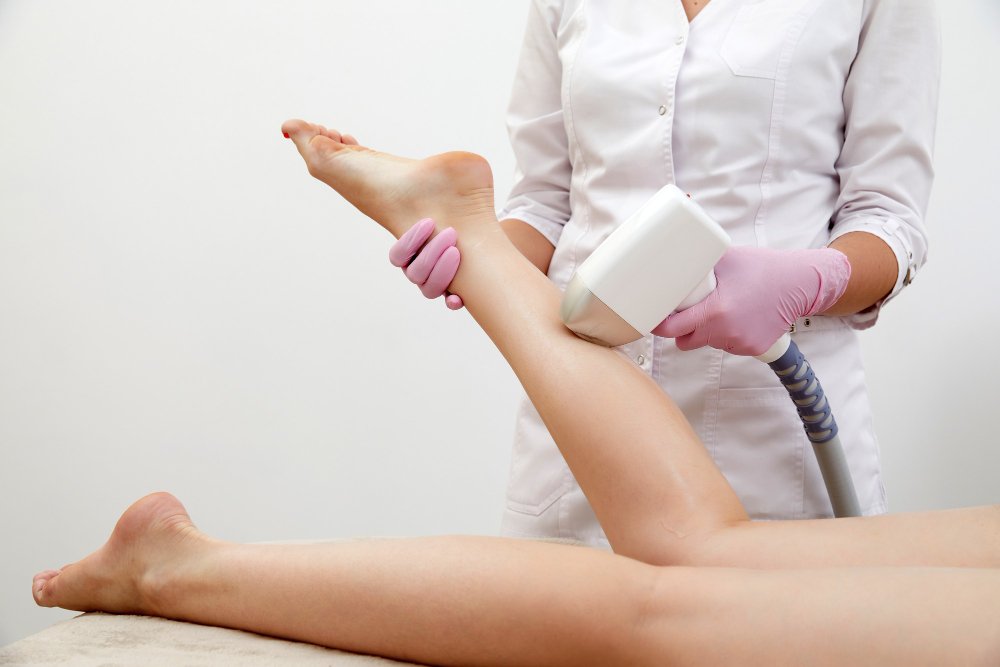 what to do after a laser hair removal session