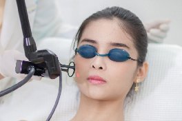 laser to remove keloid