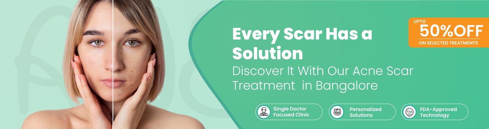 acne scar treatment in bangalore