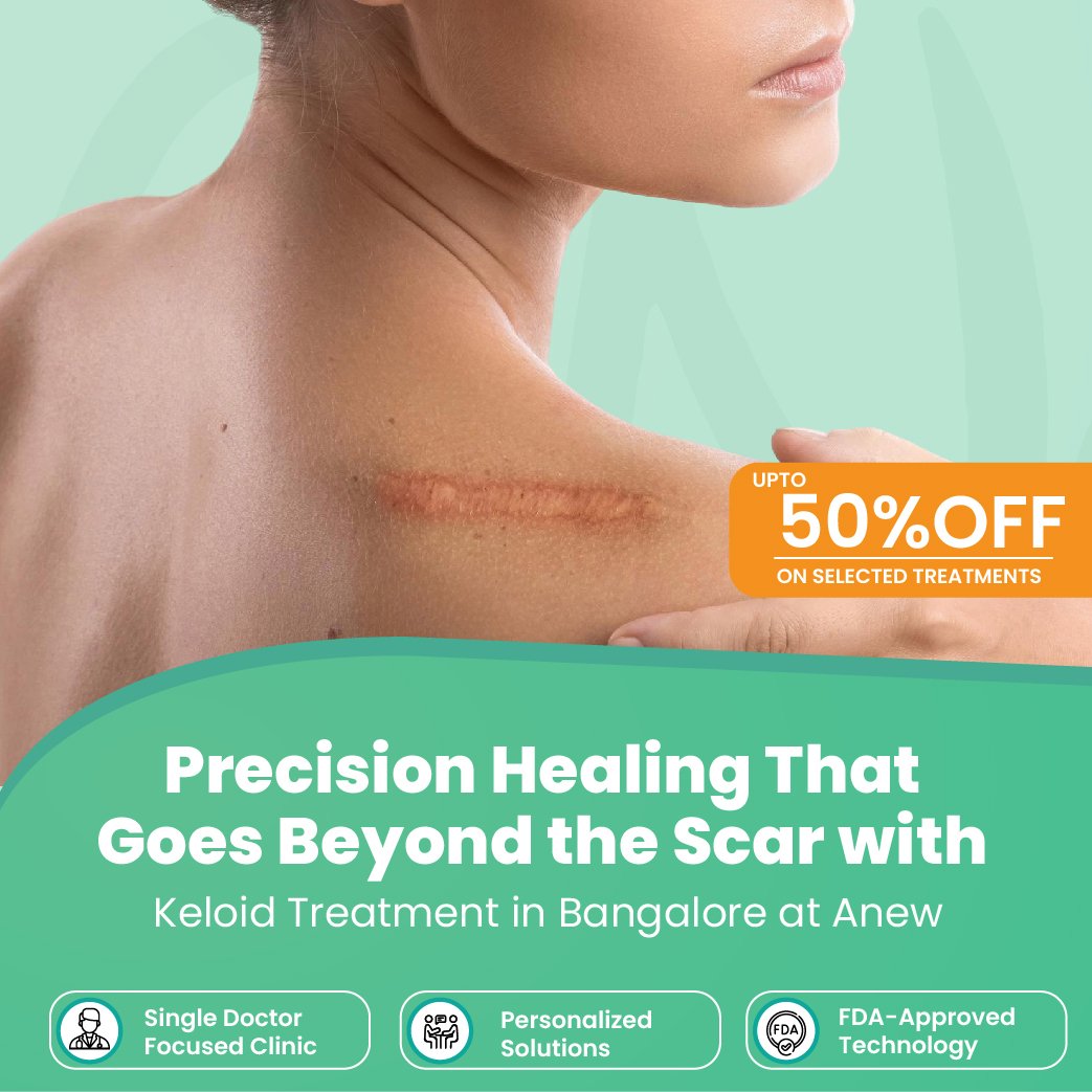 Keloid Treatment In Bangalore