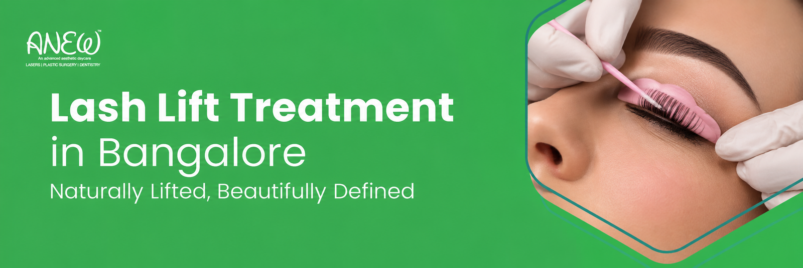 cosmetic dentist in bangalore