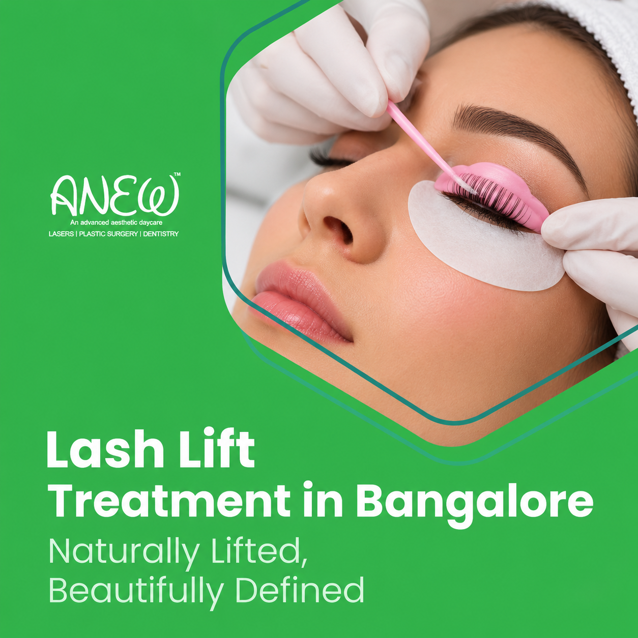 cosmetic dentist in bangalore