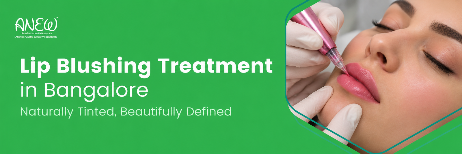 cosmetic dentist in bangalore