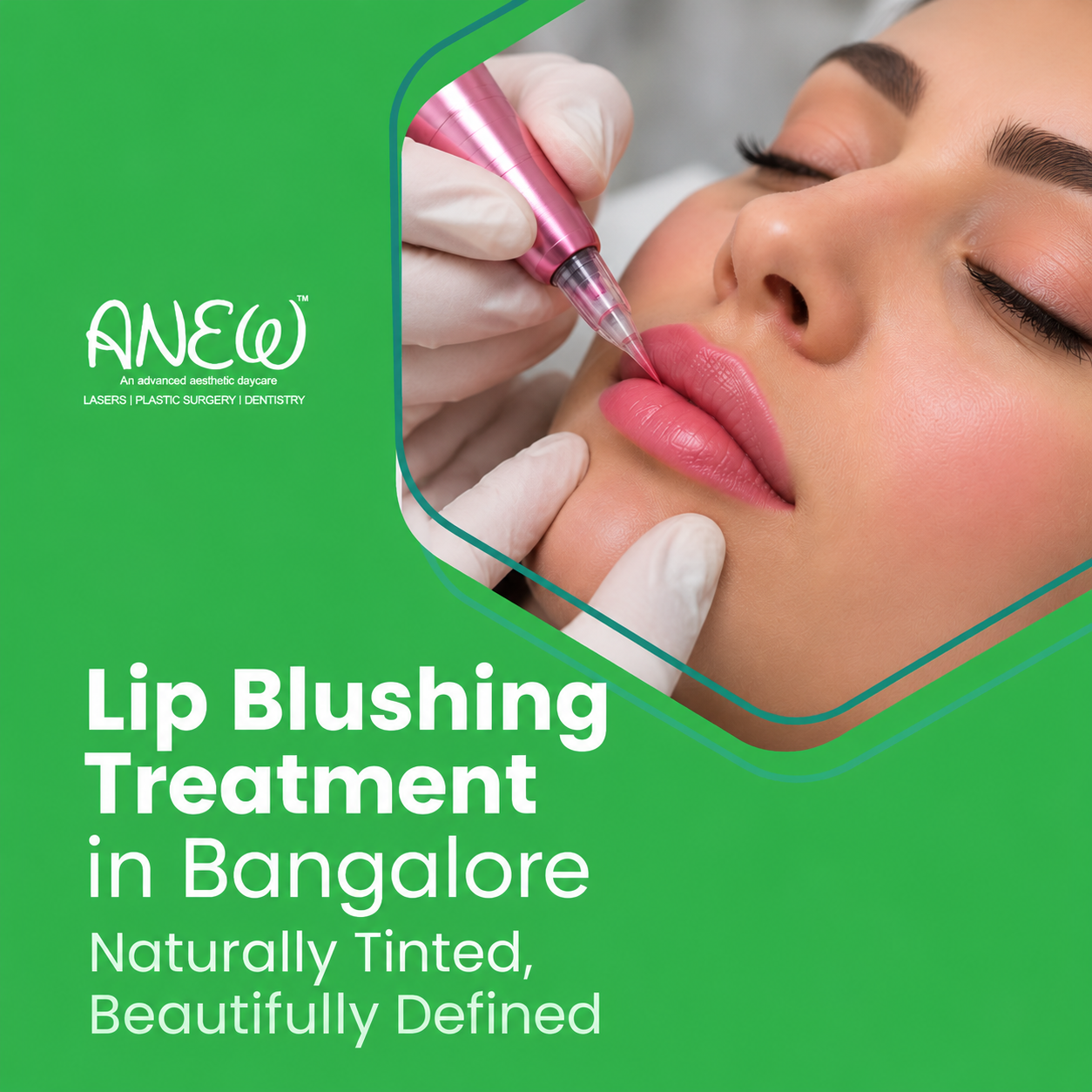 cosmetic dentist in bangalore