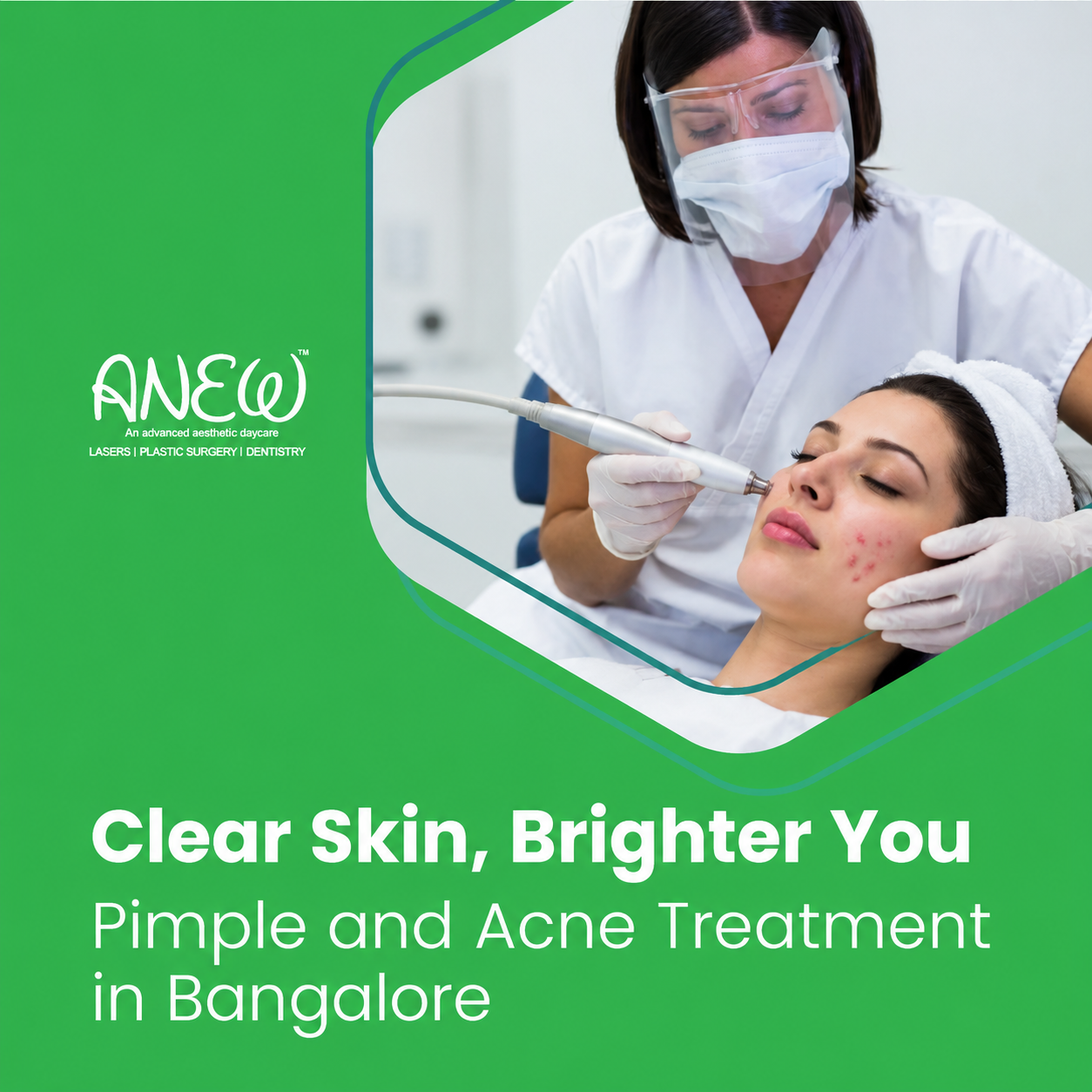 Microblading Treatment in Bangalore