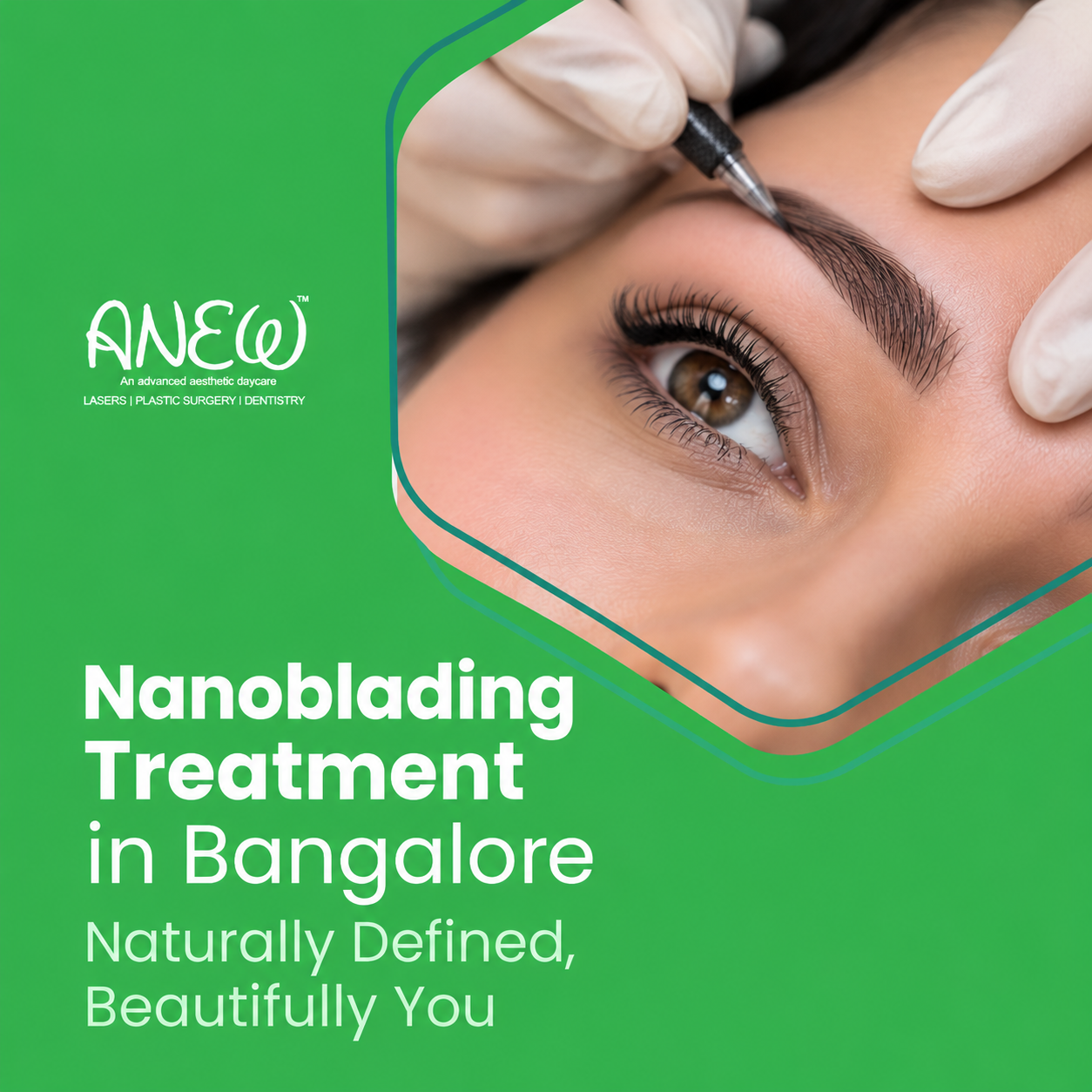 cosmetic dentist in bangalore