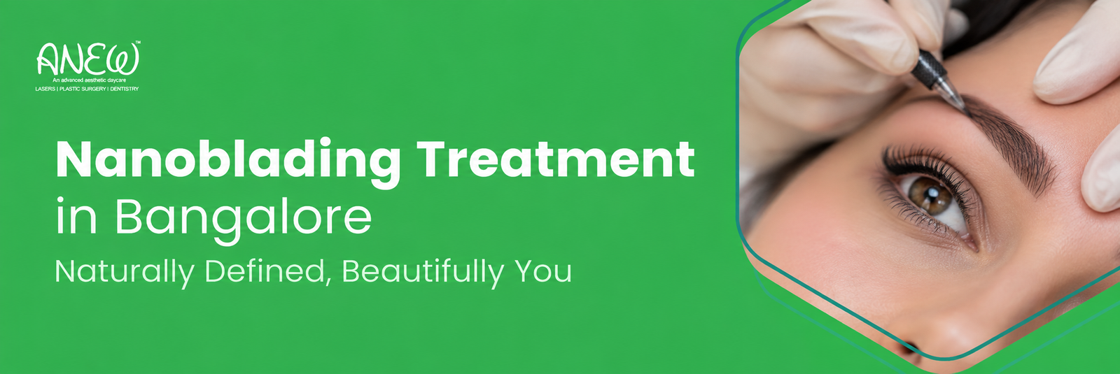 cosmetic dentist in bangalore