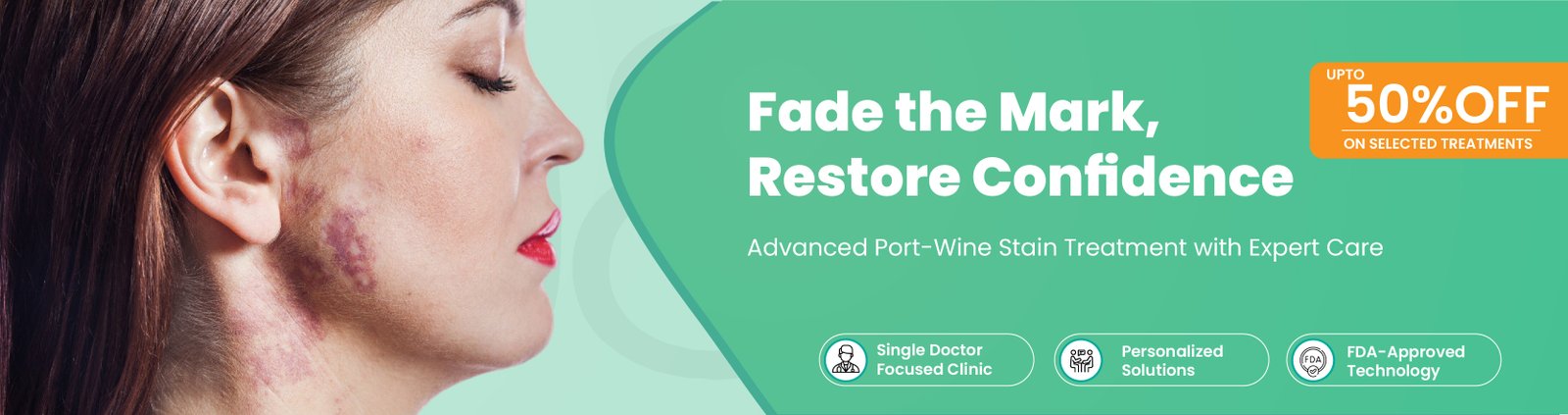 Port Wine Stains Treatment In Bangalore