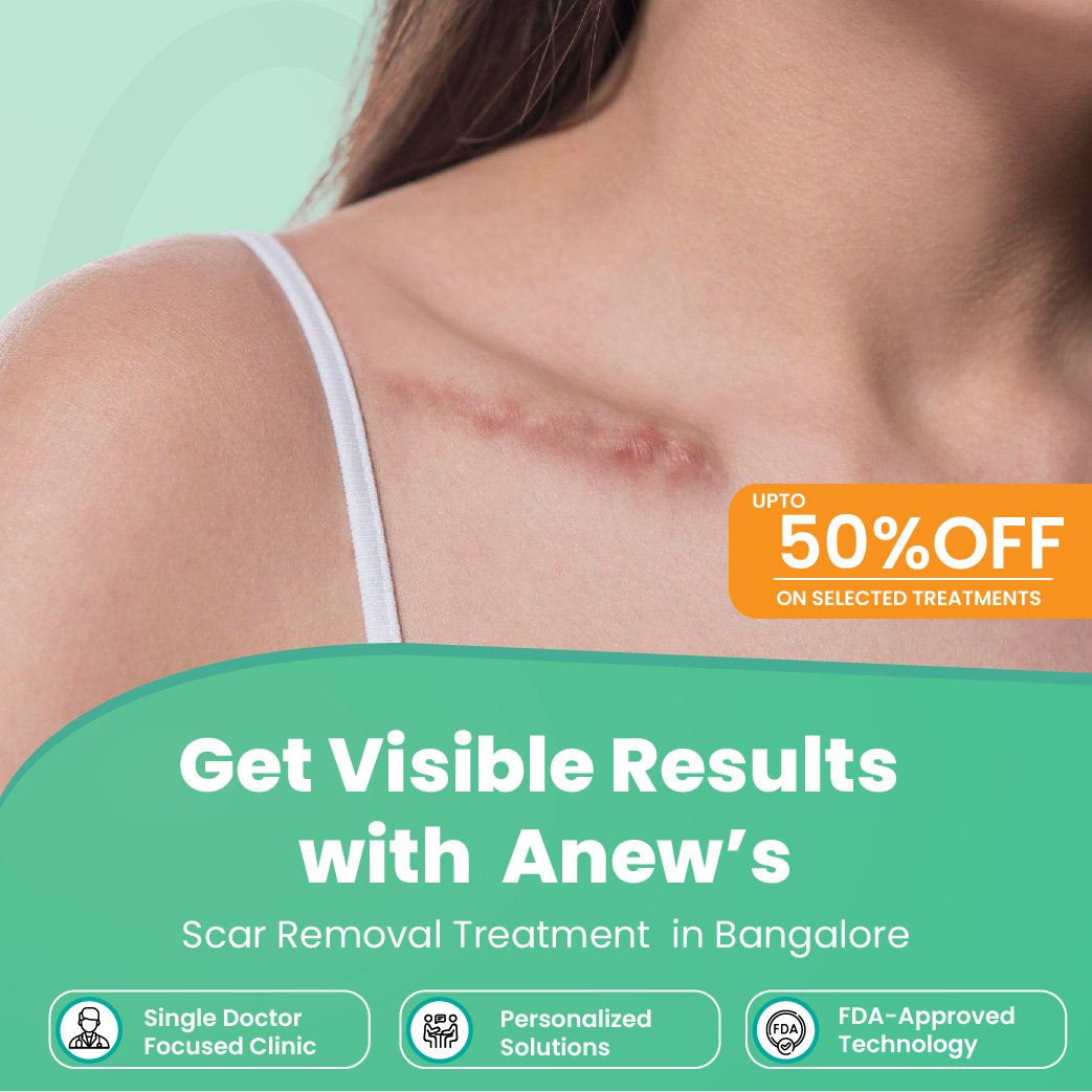 scar removal treatment in bangalore