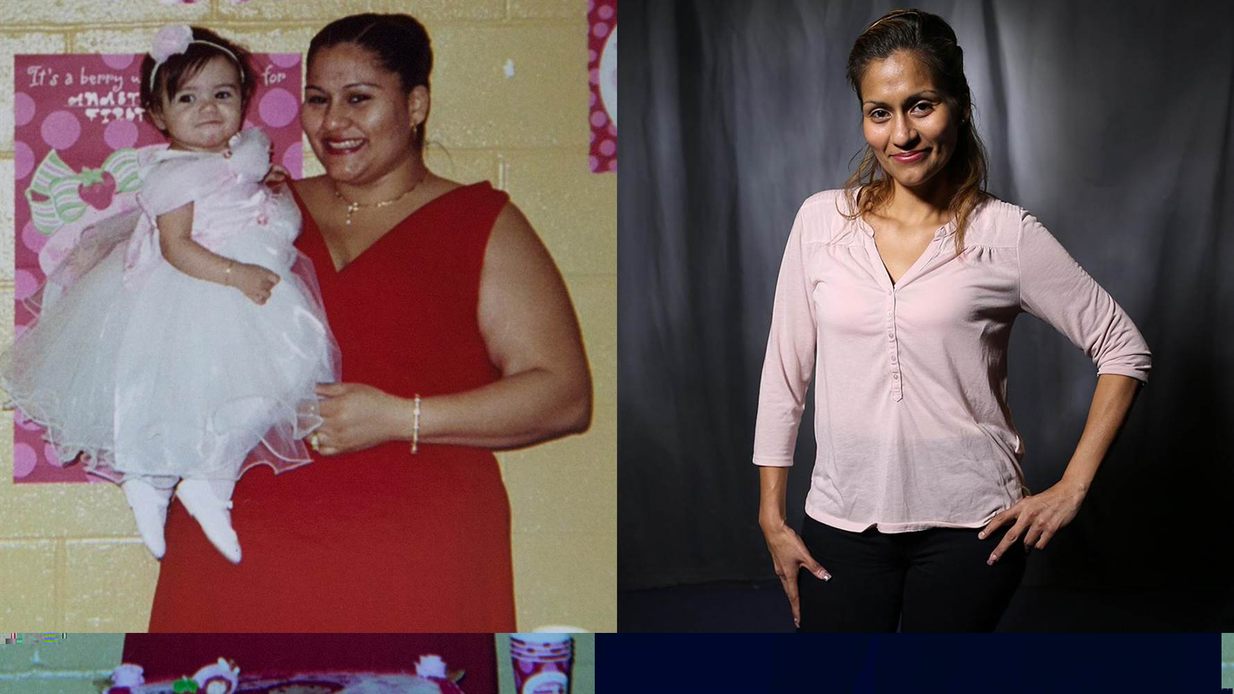 Weight Loss Surgery in Bangalore - Anew
