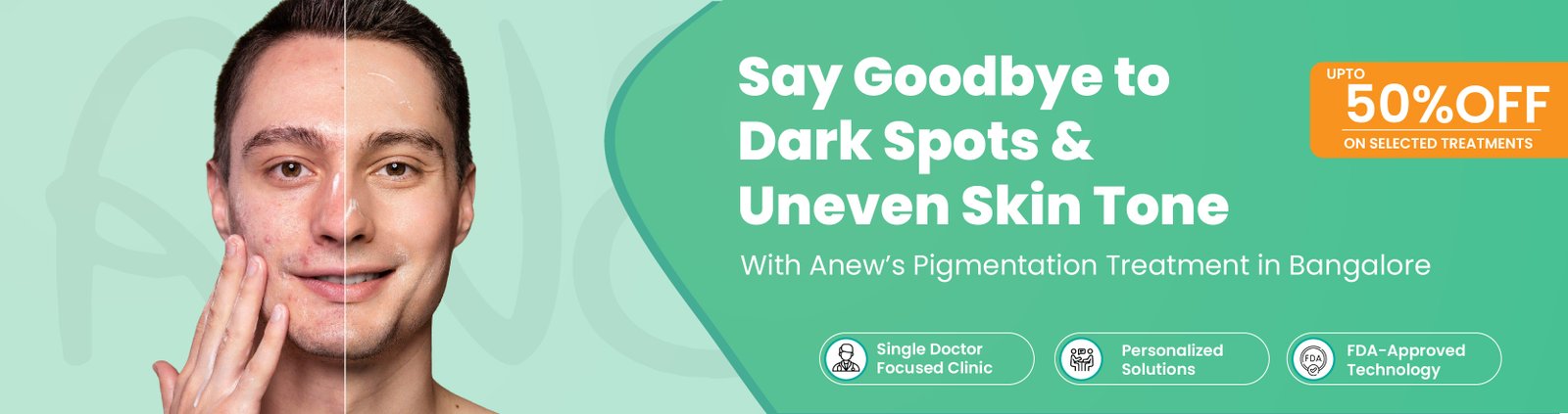 pigmentation laser treatment in Banashankari
