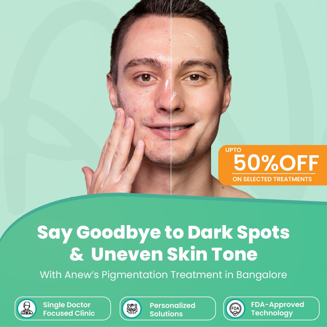 pigmentation treatment in Banashankari