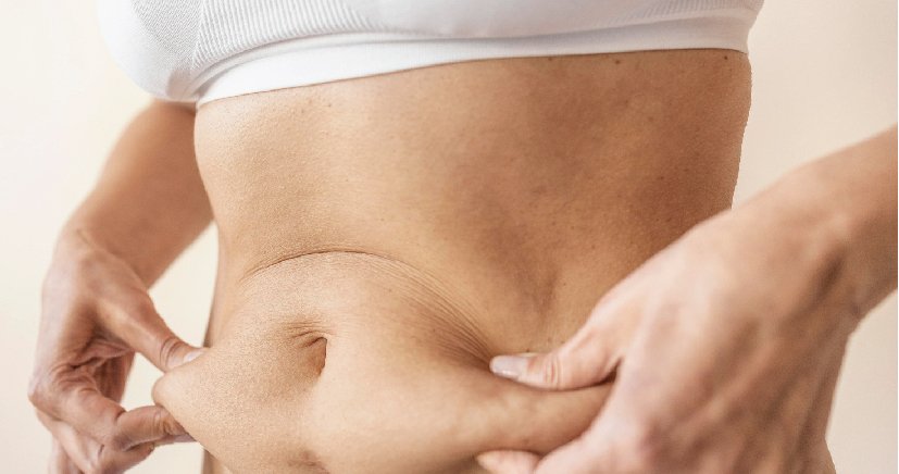 Abdominoplasty in Bangalore