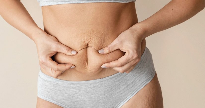 abdominoplasty cost in bangalore​