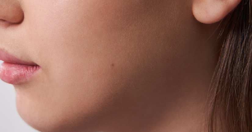  fillers in bangalore 