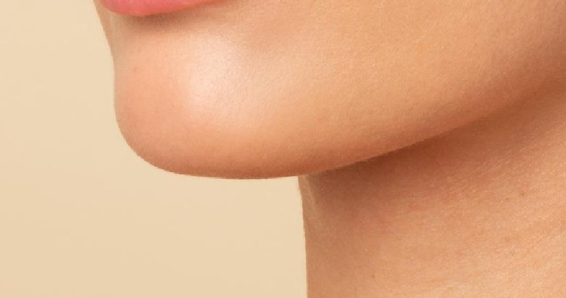 fillers in bangalore 