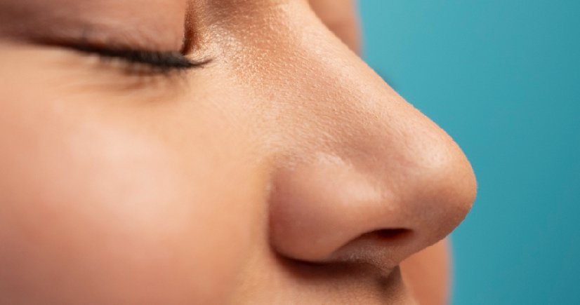 dermal fillers cost in bangalore