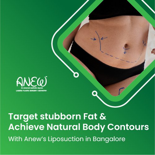 liposuction cost in bangalore