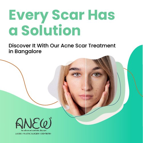 acne scar treatment in bangalore