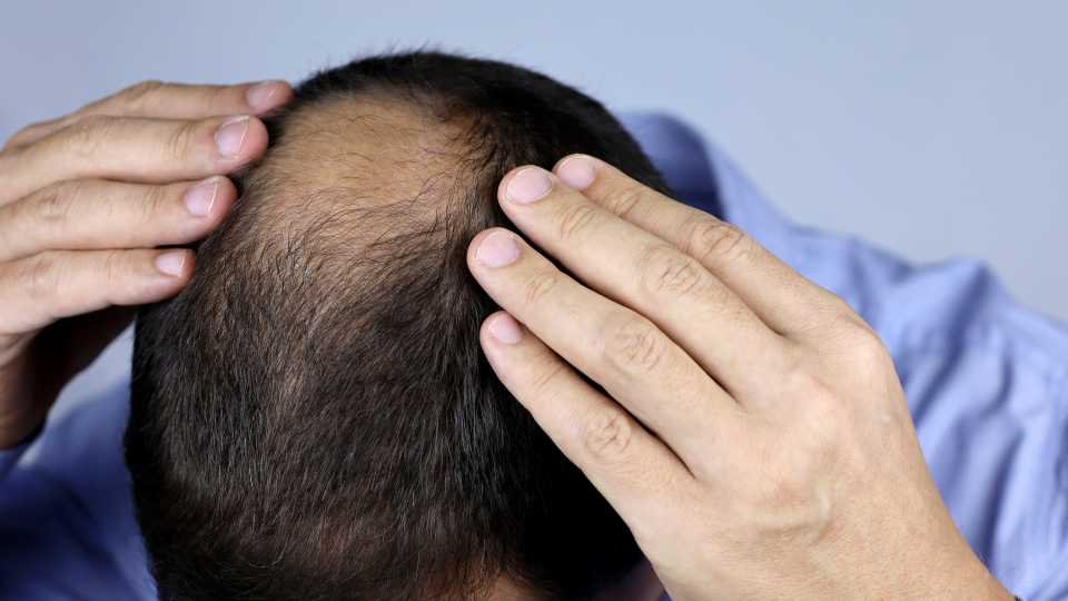 Best Hair Treatment for Hair Loss