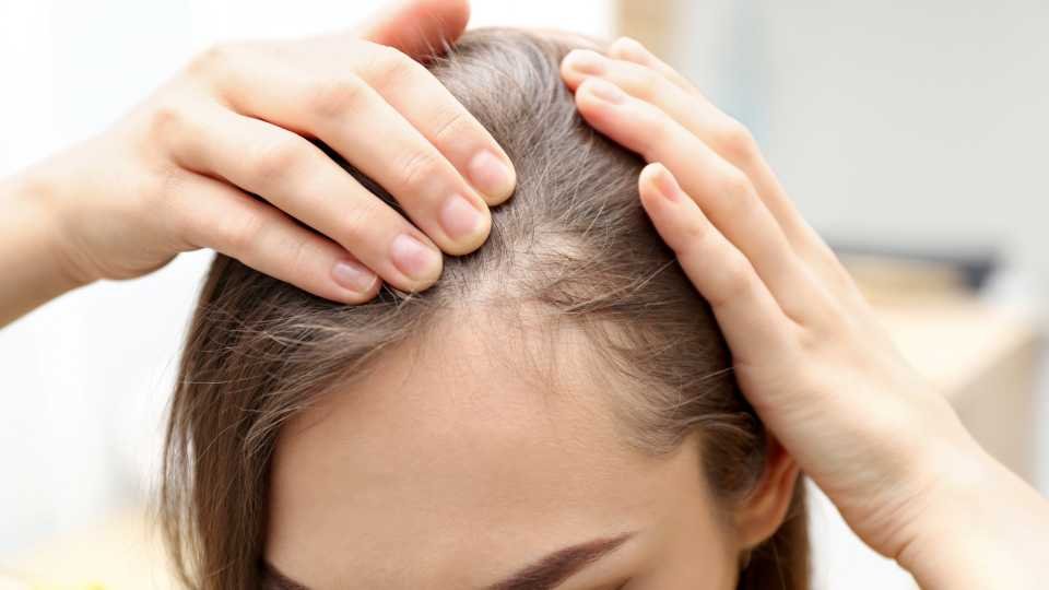 Best Hair Treatment for Hair Loss