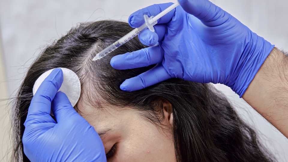 Best Hair Treatment for Hair Loss