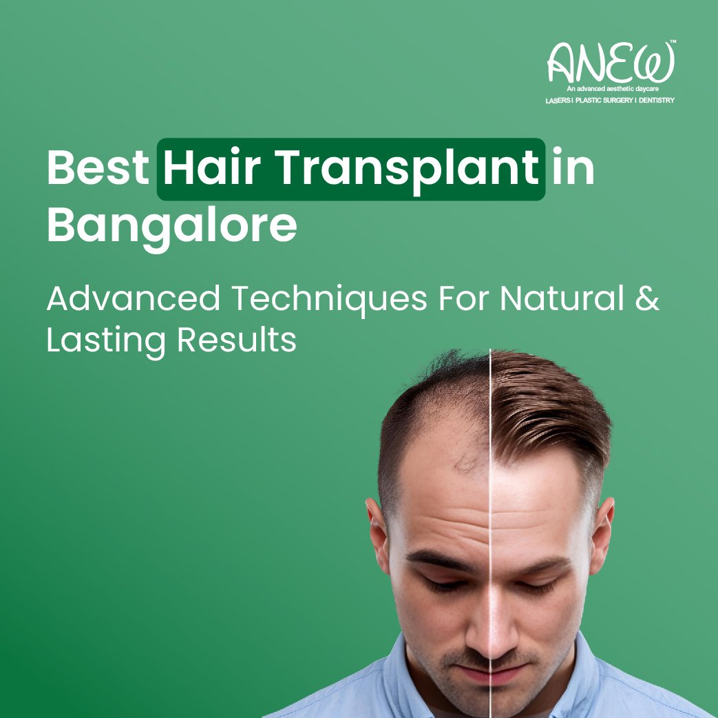 Hair transplant in bangalore 