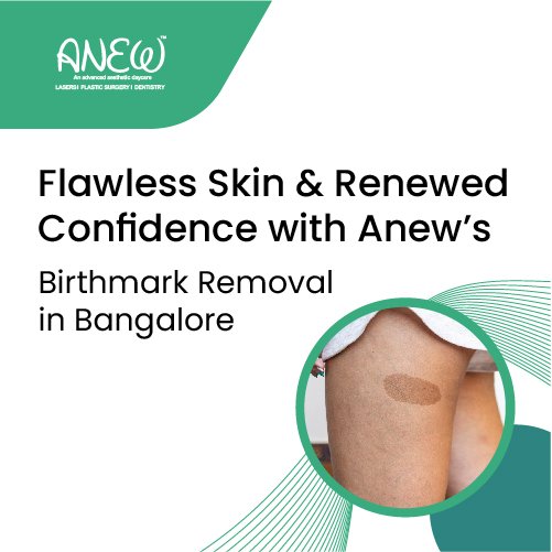 Best Birth mark removal treatment in Bangalore
