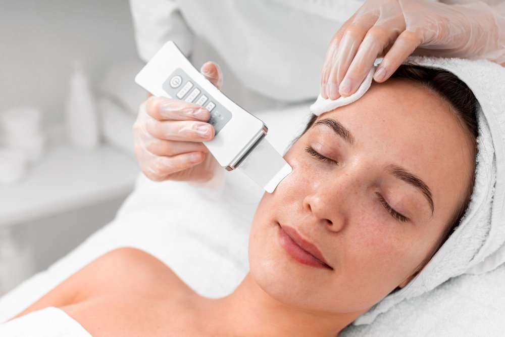 chemical peel for skin