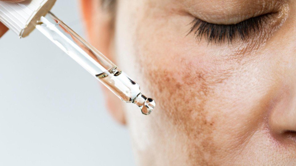 Hyperpigmentation treatment