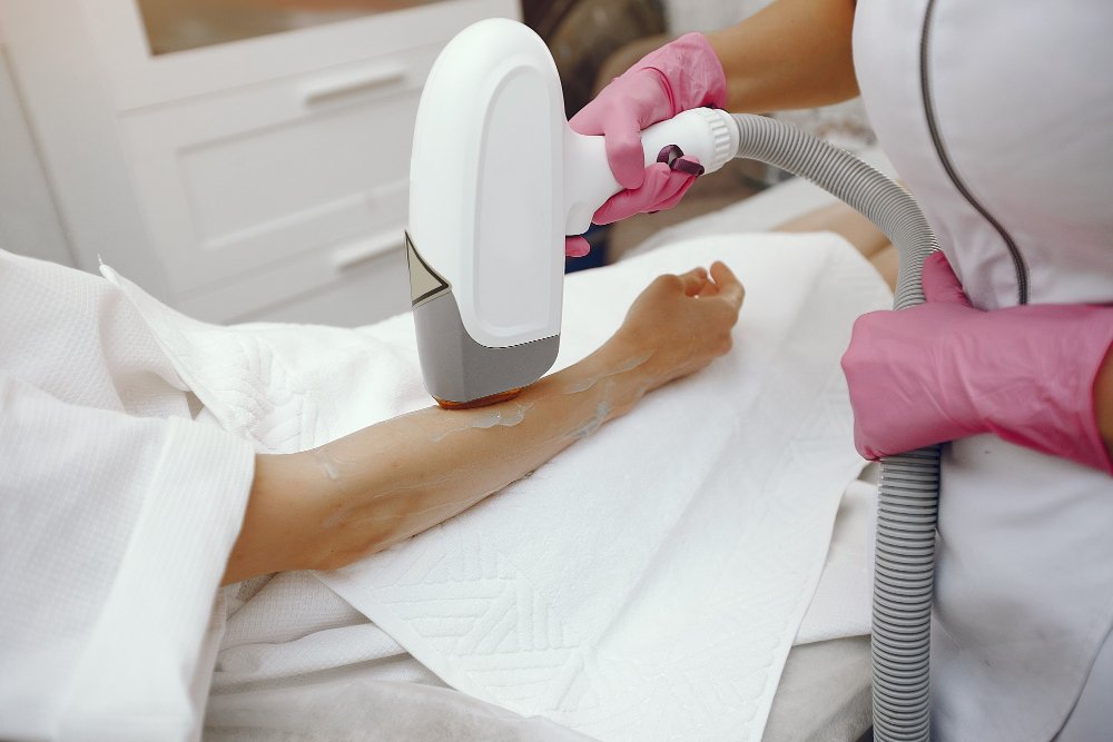 laser treatment for hair removal