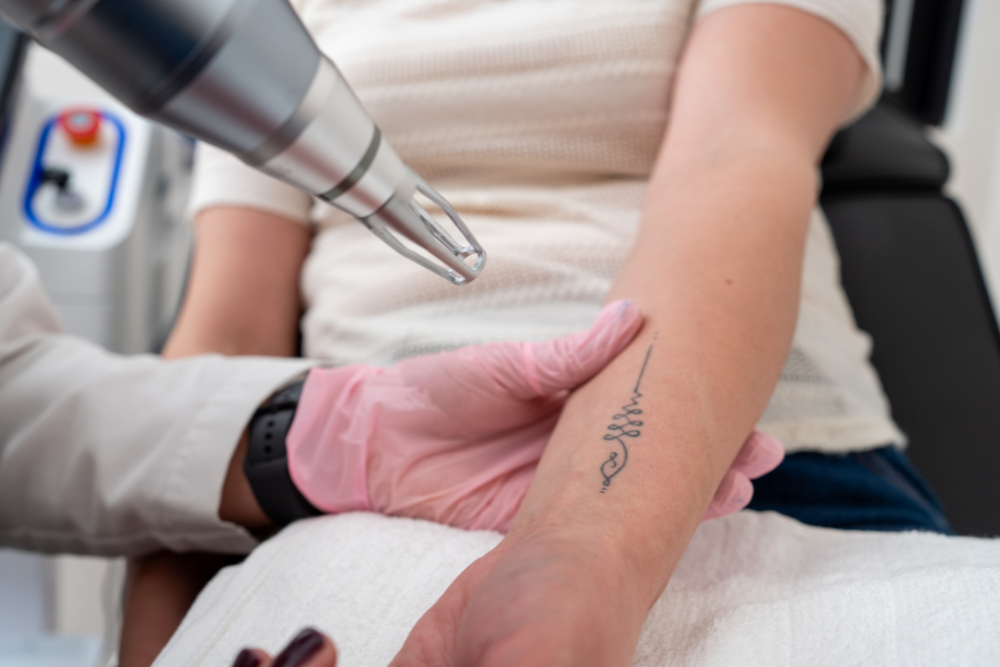 is laser tattoo removal safe