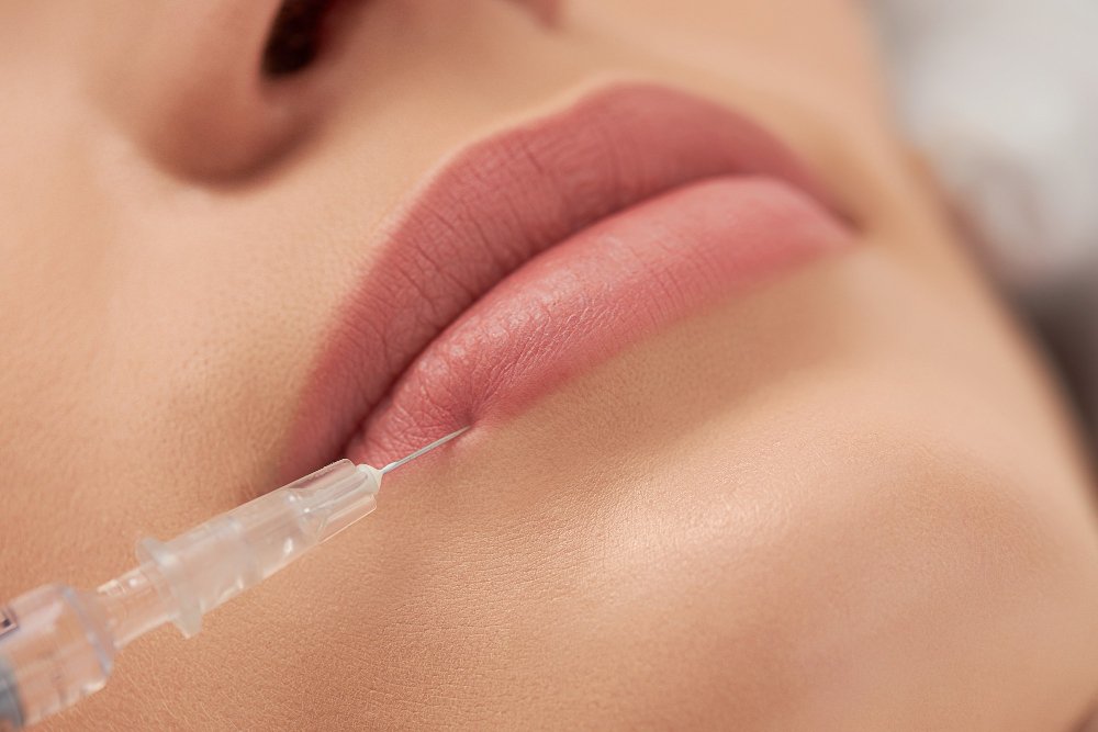 How Much Do Lip Fillers Cost? Treatment and Cost Breakdown
