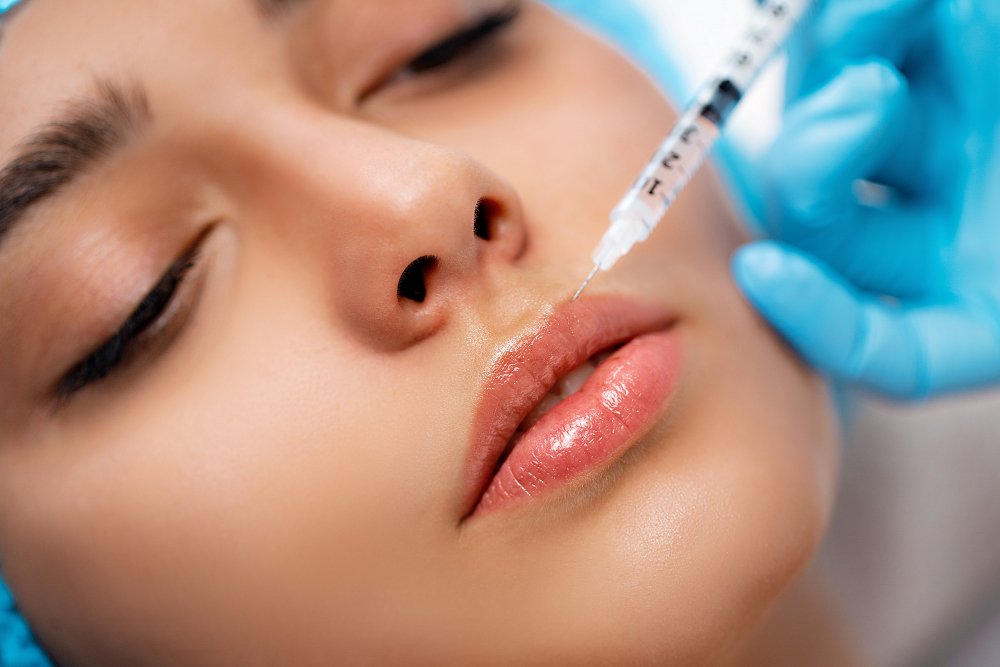 How Much Do Lip Fillers Cost? Treatment and Cost Breakdown