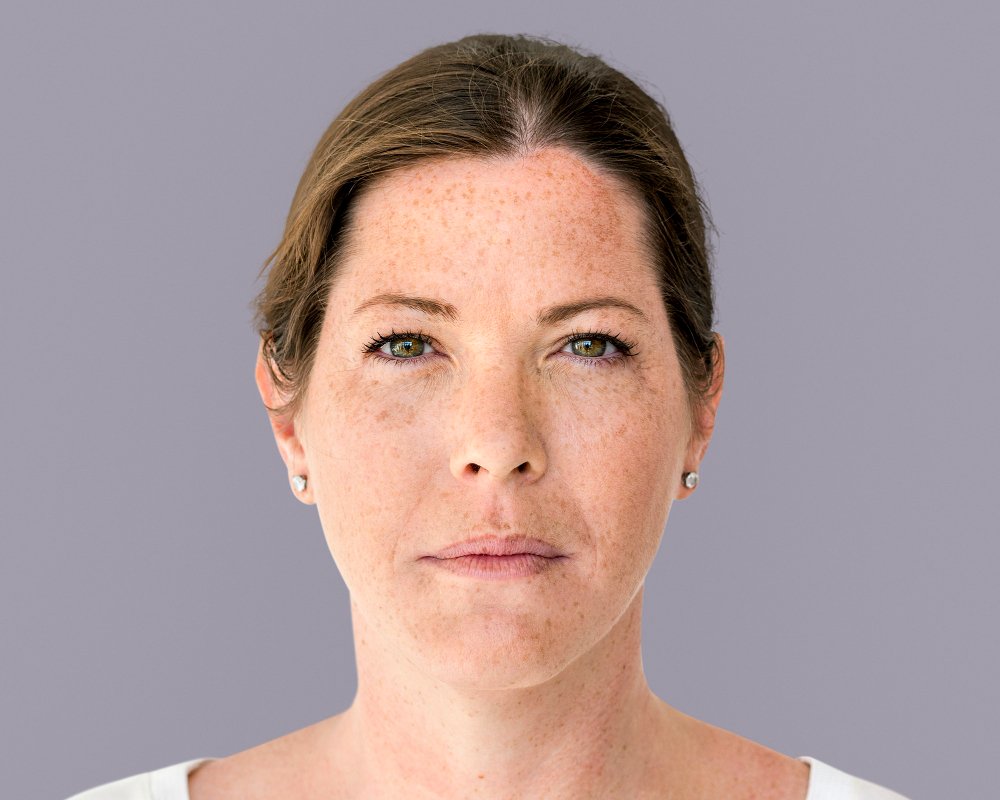 what causes pigmentation on face