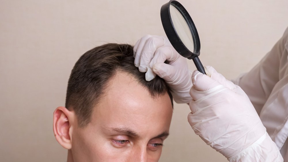 prp for hair loss
